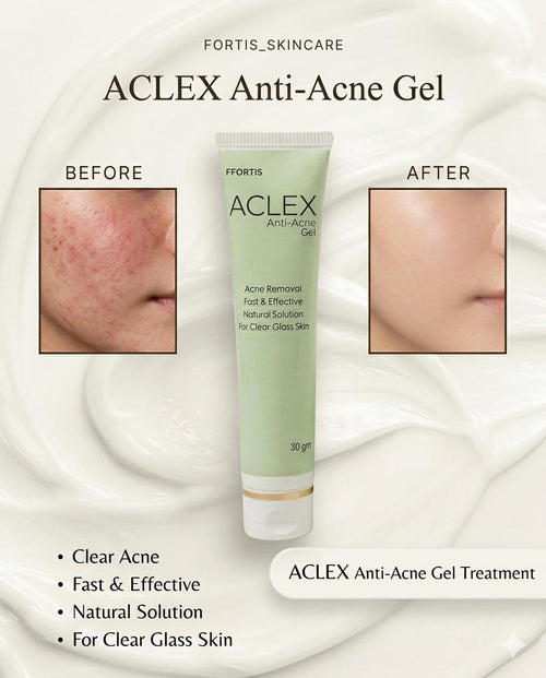 ACELEX | Anti-Acne Gel | Fast &amp; Effective Acne Care